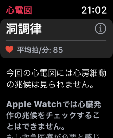 Apple Watch Series 6 を8ヶ月使用したバッテリー状態。 | ２階からMac